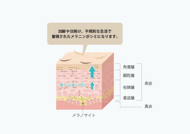 シミはなぜできるのか?
