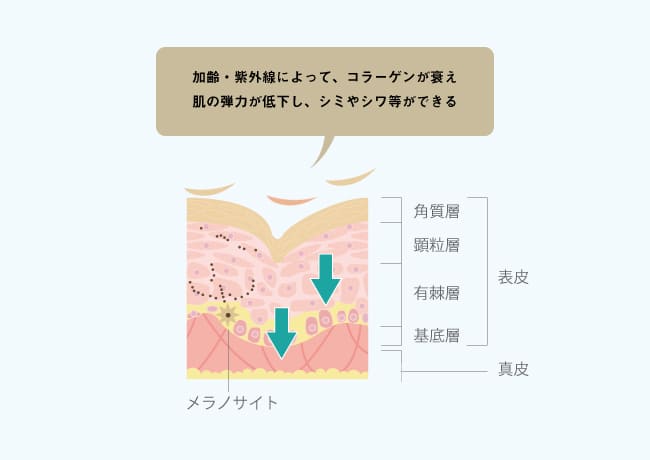 肌トラブルはなぜ起こるのか?